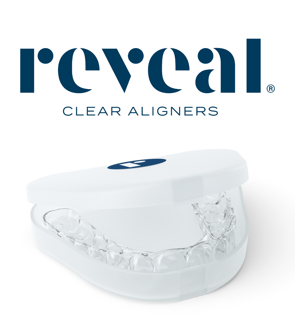 reveal clear aligners